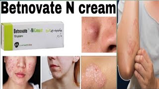 betnovate cream  betnovate n skin cream  betnovate c cream  betnovate c skin cream uses in Urdu [upl. by Alisia]