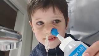 Cómo limpiar la sinusitis a un niño [upl. by Arinaj]