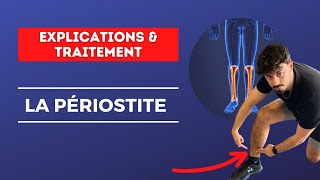 Comment en FINIR avec ta PÉRIOSTITE   EXPLICATIONS amp TRAITEMENT [upl. by Jud]