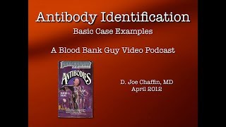 Antibody ID The Basics Part 1 [upl. by Oram]