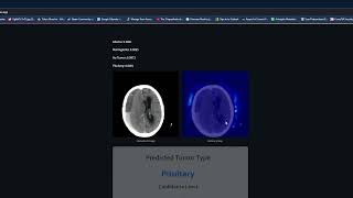 Brain MRI Tumor Classifications Demo [upl. by Grady]