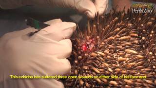 Treating a Wild Echidna in Perth Zoos Veterinary Hospital [upl. by Ahsai]