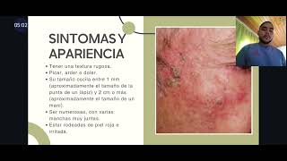 QUERATOSIS ACTÍNICA  Jorge Tamara  Rot 2524 DERMATOLOGÍA [upl. by Tita850]