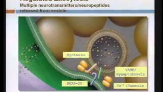 Spasticity Management [upl. by Lahey]