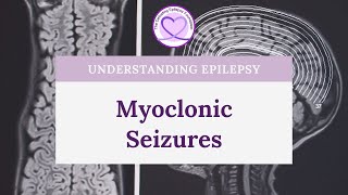 What are Myoclonic Seizures [upl. by Marya125]