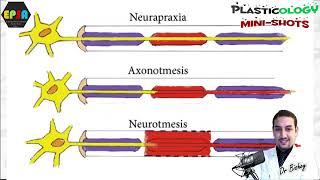 Plasticology  Nerve Injuries Classifications Tips amp Tricks [upl. by Ettesoj]