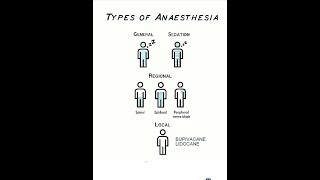 Anesthesia preassessmenttypesscalesASA Malam Patti Cormac Lehan medicsindicationscontra [upl. by Niessuh246]