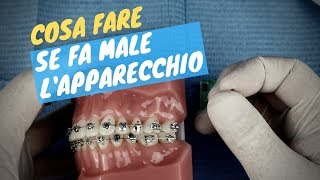 Fa male lapparecchio Ecco cosa fare [upl. by Sheena]