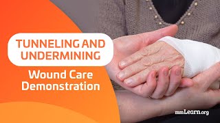 Tunneling and Undermining  Wound Care Demonstration [upl. by Virg]