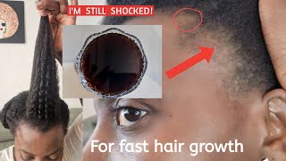 HOW TO GROW YOUR EDGESNATURAL HAIR GROWTH TIPS4C HAIRHOW TO GROW YOUR HAIR WITH CLOVESALOPECIA [upl. by Corene]