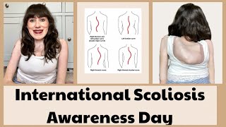 International Scoliosis Awareness Day  Wednesday 26th June 2024 [upl. by Aleacim]