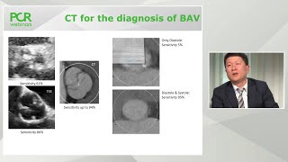 TAVI in bicuspid valve disease  PCR Webinar Round Table [upl. by Westbrooke92]