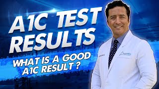 A1C test for Diabetes HbA1c  What is a Good A1C Test Result SUGARMD [upl. by Ahsataj]