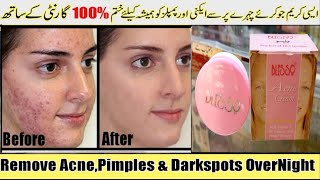 Acne cream  Blesso acne pimple dark spots remove cream  with vitamin E uv protector [upl. by Pillyhp]