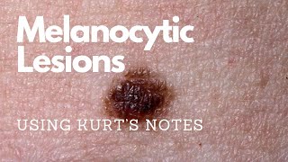 Melanocytic Lesions Kurtâ€™s Notes pathagonia [upl. by Natka]