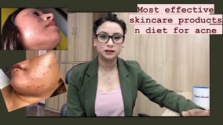 Most effective skincare products for acne acnetreatmenthowtogetridofacnemaskacnetreatmentsuzu [upl. by Hera917]