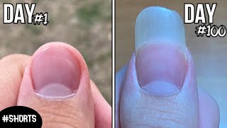 100 Days Of Fingernail Growth  Time Lapse shorts [upl. by Otrebtuc]