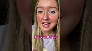 Rosacea flare up close up 💖 redness rosacea rosaceaawareness rosaceawithrose sensitiveskin [upl. by Yerg]