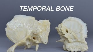 TEMPORAL BONE [upl. by Ace102]