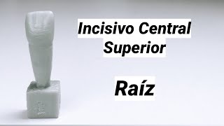 INCISIVO CENTRAL SUPERIOR TALLADO EN CERA 🦷🦷🦷 RAÍZ Y DETALLES [upl. by Tenenbaum120]