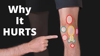 Why Your Knee Hurts Knee Pain Types by Location Chart  Symptoms [upl. by Saduj]