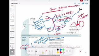 Basilar artery strokes neurology 75  First Aid USMLE Step 1 in UrduHindi [upl. by Kcirddahc]