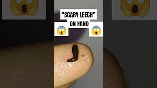 Scary Leech on hand shorts leech insects worms scaryanimal [upl. by Noed]