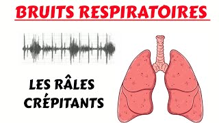 Les RÂLES CRÉPITANTS  bruits respiratoires [upl. by Akinnej557]