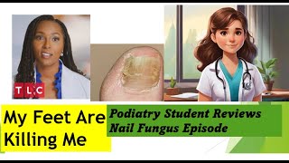 Podiatry Student reviews Brandon Never Washes His Feet  My Feet Are Killing Me nailfungus [upl. by Lekkim]