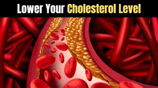 How to lower your cholesterol levels naturally UrduHindi Nutritionist Haris Anees [upl. by Rouvin581]