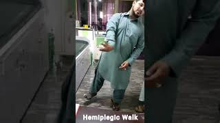 Hemiplegic Cerebral palsy  Hemiplegic gait [upl. by Holmes]