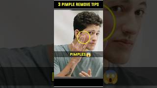 🔥3 Pimple Remove Tips  shorts pimples menfashion [upl. by Etnelav]