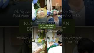 Pilih treatment sesuai dengan kondisi kulit lo dan booking sekarang✨ [upl. by Seiuqram672]