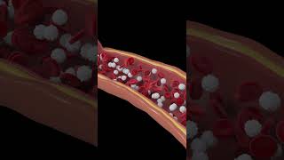 Platelets and plasma in blood [upl. by Ainak]