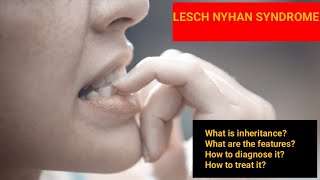 Lesch Nyhan Syndrome  Features Diagnosis Treatment Inheritance [upl. by Enelia]