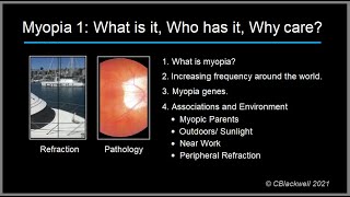 Myopia 1 What is it Who has it and Why care [upl. by Kcirderf790]