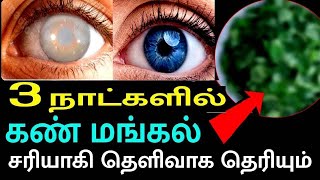 👁️ 3 நாட்களில் கண் கண்ணாடியை தூக்கி எறிவீர்கள்  Eyesight Increase Remedy in Tamil  HH [upl. by Kristos384]