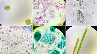 Microscopic Slides of Algae Live and Prepared [upl. by Enyluqcaj342]