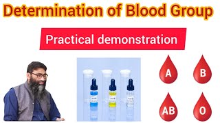 ABO Blood Grouping and Rh Factor Hematology amp Physiology Practical [upl. by Remmer]