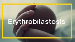 quotErythroblastosis Causes Symptoms  Understanding Hemolytic Disease of the Newbornquot [upl. by Carlos]