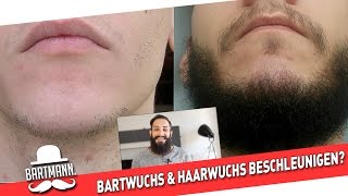 BARTWUCHS amp HAARWUCHS BESCHLEUNIGEN MIT MINOXIDIL  BARTMANN [upl. by Raymonds71]