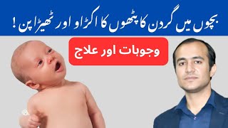 Torticollis in Babies Causes Symptoms and Treatment Options Explained  urdu amp hindi [upl. by Ernestine212]