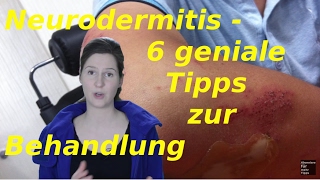 Neurodermitis Gesicht  6 Tipps zur Behandlung [upl. by Oironoh]