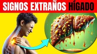 ¿Dolor De Hombro Derecho 💥 ASÍ SE VE TU HÍGADO 7 Signos EXTRAÑOS de DAÑO en el HÍGADO  CUIDADO [upl. by Iturk112]