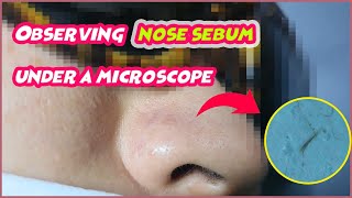 Observing nose sebum under a microscope [upl. by Soneson]