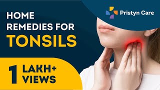 टॉन्सिलाइटिस का घरेलू उपचार  Home remedies for Tonsillitis [upl. by Stirling]