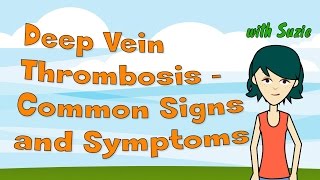 Deep Vein Thrombosis  Common Signs and Symptoms [upl. by Senecal]