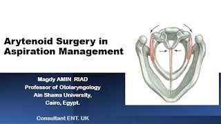 Arytenoid Surgery in Aspiration Management [upl. by Nepean937]