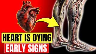 10 Warning Signs of Blocked Heart Arteries In Legs and Feet Dont Ignore These Signals [upl. by Parris315]