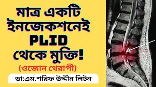 Disc Bulge Treatment Without Surgery  PLID Disc Herniation  DrMSharif Uddin Liton [upl. by Annaegroeg]